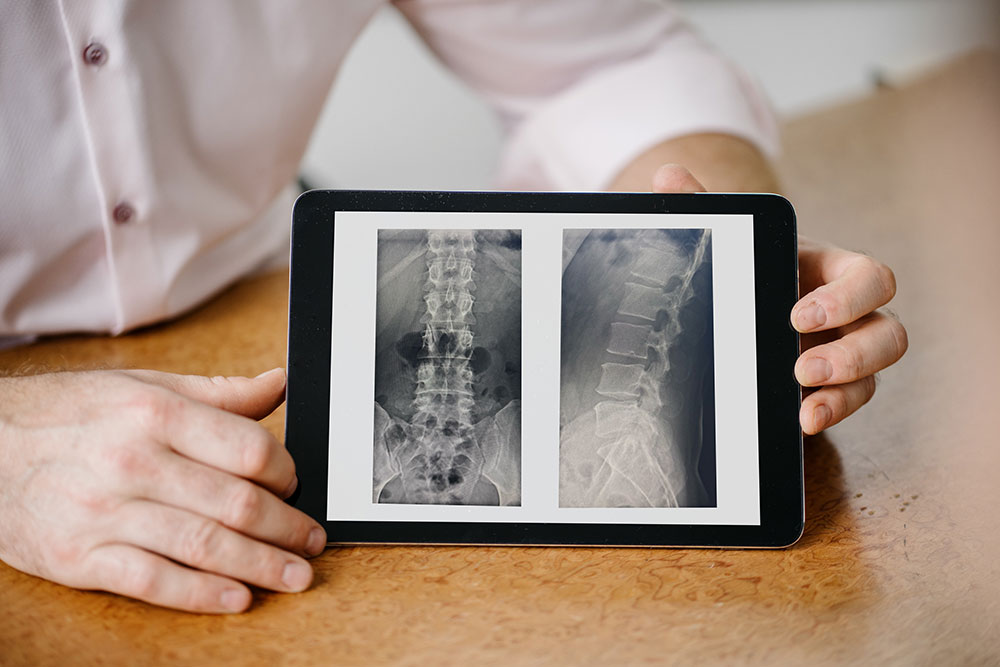 orthopaedie-weilimdorf-garkuscha- digitales-roentgen orthopaedie-weilimdorf-garkuscha- digitales-roentgen